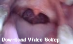 Bokep Bagian Depan Endoskopi 2018 - Download Video Bokep