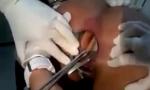 Vidio Bokep Médicos removem dildo preso no cu de mulher mp4