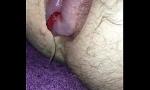 Video Bokep Bleeding man sy anal suction cup