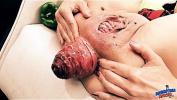 Film Bokep Insanely Huge Prolapse excl Cervix Exposure period Eggplant Penetratio terbaru