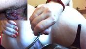 Bokep HD Hardcore anal session with a medical endoscope a super medical fetish video 3gp