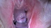 Bokep Seks Cum Injection with Syringe in Cervix Utherus after Fucking 3gp online